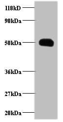IHC-plus™ Polyclonal Rabbit anti-Human CCL2 / MCP1 Antibody (IHC, WB)