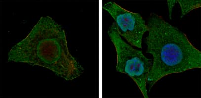PathPlus™ BRAF / B-Raf Antibody (clone 1H12)