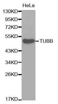 TUBB / Beta Tubulin Antibody