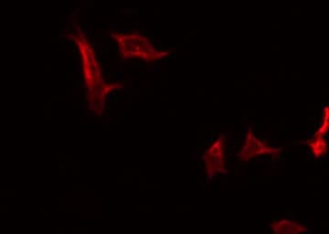 Polyclonal Rabbit anti-Human CD200R1 / CD200R Antibody (IF, WB)