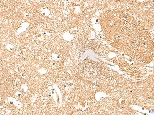 HPCA / Hippocalcin Antibody