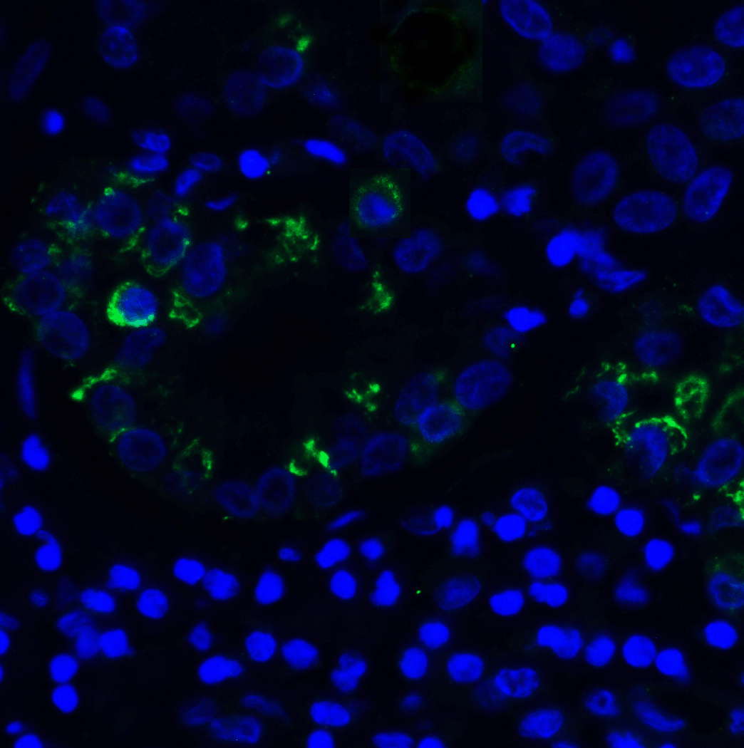 IHC-plus™ TIGIT Antibody (clone 3B5)