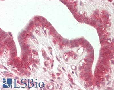 IHC-plus™ Polyclonal Rabbit anti-Human HK1 / Hexokinase 1 Antibody (IHC, IF, WB)