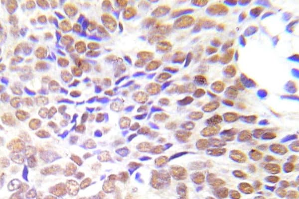HDAC1 Antibody (aa378-427)