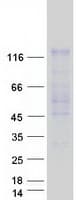 Human USP20 / VDU2 Protein (Recombinant Myc-DDK (Flag))