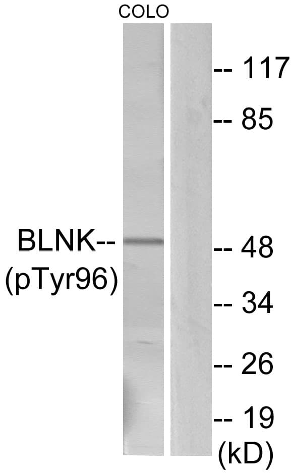 BLNK Antibody (phospho-Tyr96)