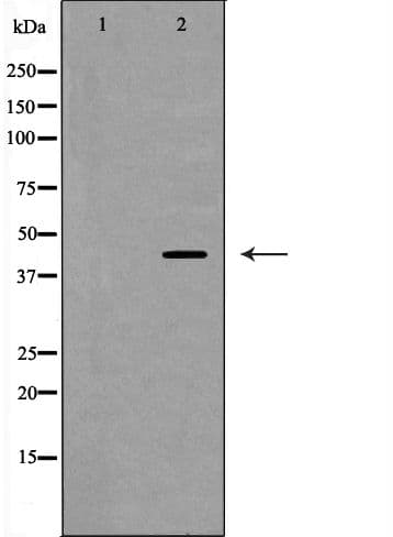 SELL / L-Selectin / CD62L Antibody