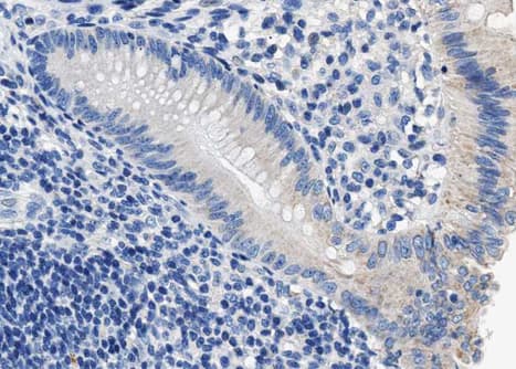 PPP1R1B / DARPP-32 Antibody (phospho-Thr34)