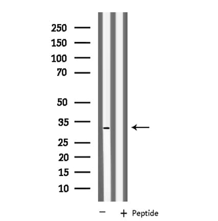 KCNK6 / TWIK-2 Antibody