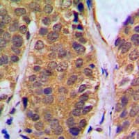 Polyclonal Rabbit anti-Human NFKB1 / NF-Kappa-B Antibody (phospho-Ser927, IHC, IF, WB)