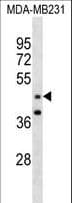 Polyclonal Rabbit anti-Human GRAMD3 Antibody (aa15-43, WB)