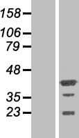 PHF20L1 Protein (Over-Expression Lysate Myc-DDK (Flag))