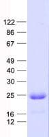 Human HCA557B / METTL21A Protein (Recombinant His, N-Terminal)