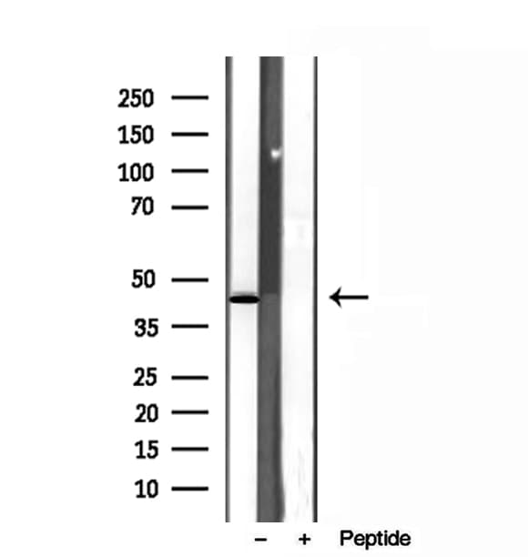 SPOP Antibody