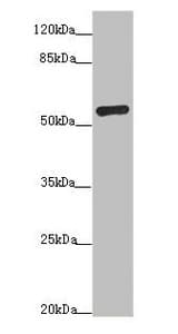 Polyclonal Rabbit anti-Human ADPGK Antibody (IHC, WB)