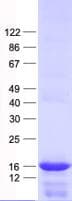 Human PRELID2 Protein (Recombinant His, N-Terminal)