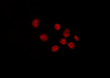 BACH1 Antibody