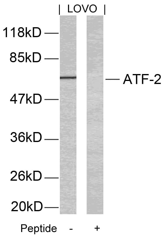 IHC-plus™ ATF2 Antibody (Thr51)