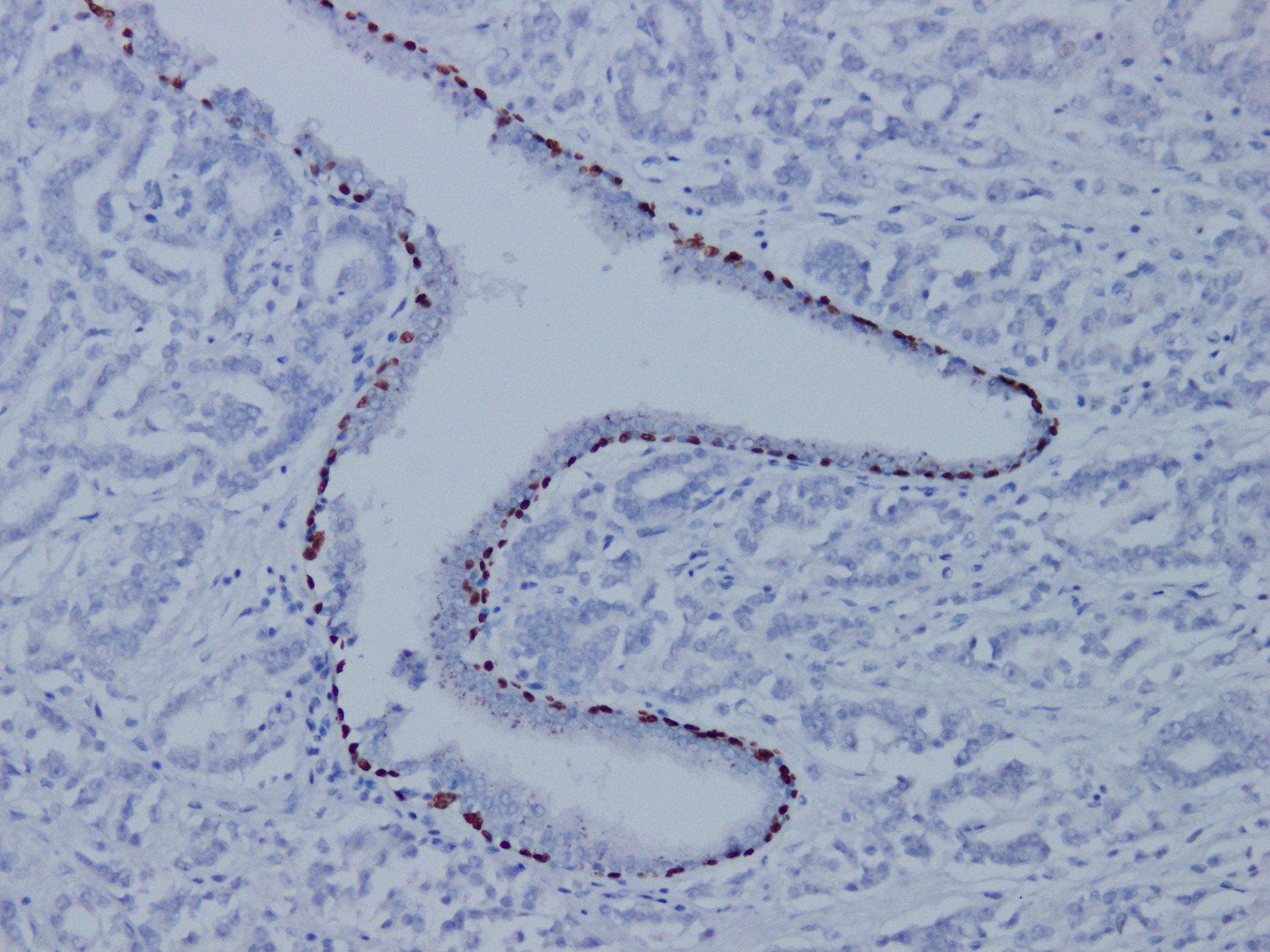 Monoclonal Mouse anti-Human CKAP4 Antibody (IHC)