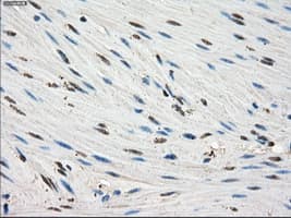 FKBP5 / FKBP51 Antibody (clone OTI3E9)