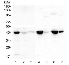 Polyclonal Rabbit anti-Human CKM / Creatine Kinase MM Antibody (IHC, WB)