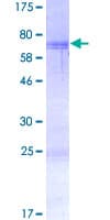 Human DJ858B16.2 / PISD Protein (Recombinant GST)