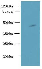 Polyclonal Rabbit anti-Human ABI3 Antibody (IHC, WB)