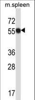 MATK Antibody (aa477-505)