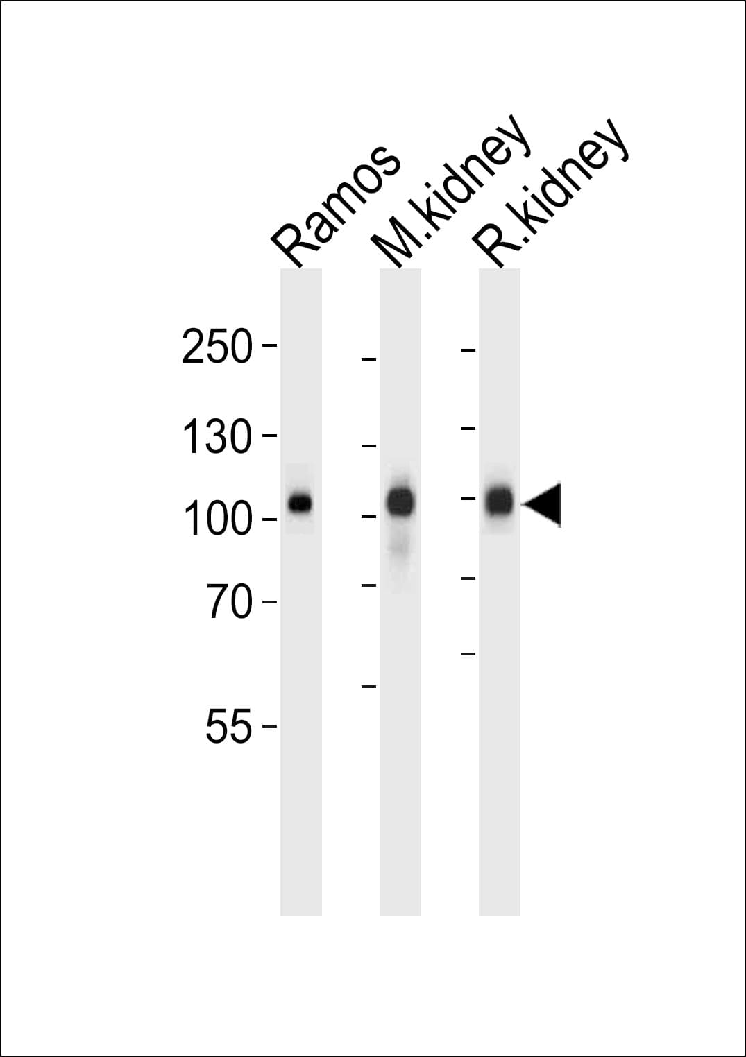IHC-plus™ Polyclonal Rabbit anti-Human MME / CD10 Antibody (aa274-302, IHC, IF, WB)