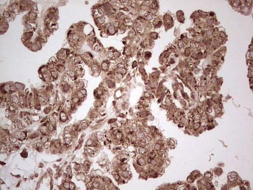 MTDH / Metadherin Antibody (aa70-582, clone OTI6H2)