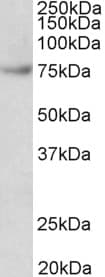 IHC-plus™ FUBP1 Antibody (aa160-174)
