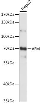 Polyclonal Rabbit anti-Human AFM / Afamin Antibody (WB)