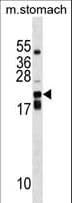 CDC42EP2 Antibody (aa133-160)