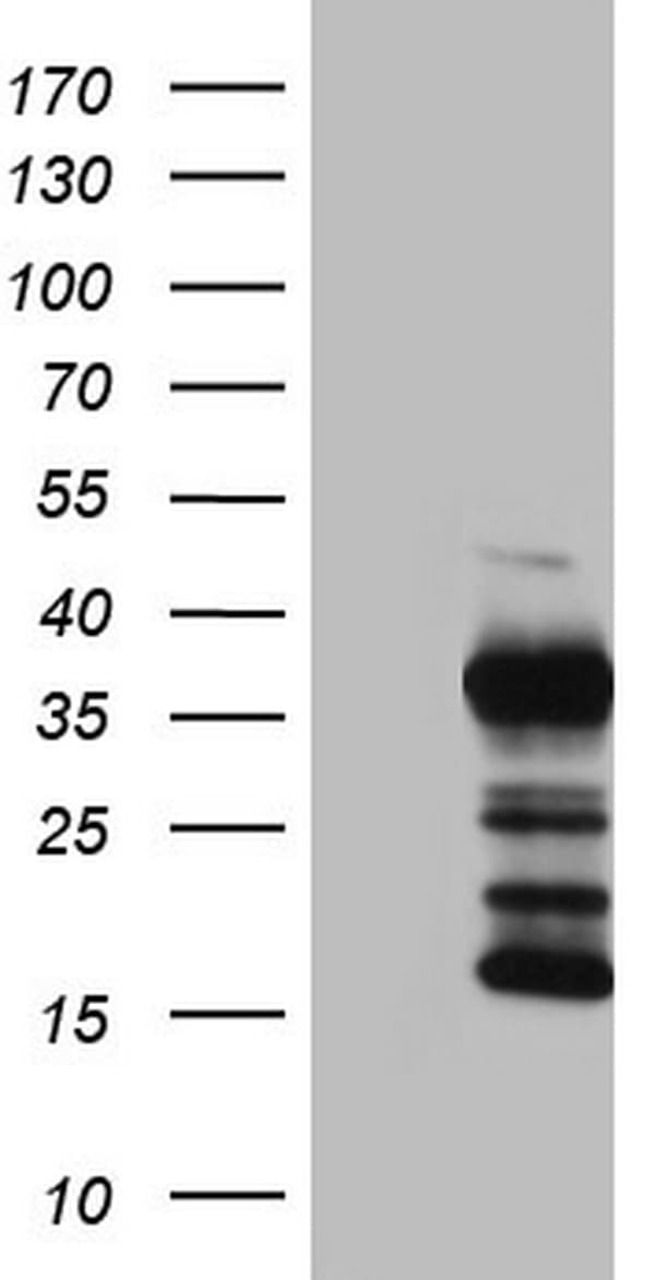 TG / Thyroglobulin Antibody (aa2511-2768, clone OTI3E12)
