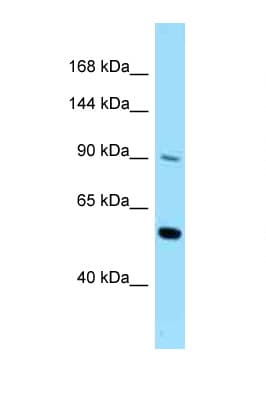 Polyclonal Rabbit anti-Human CSF2RB / CD131 Antibody (aa578-627, WB)