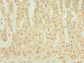 Polyclonal Rabbit anti-Human ELMOD1 Antibody (IHC)