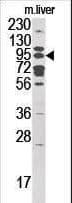 Polyclonal Rabbit anti-Human GCS1 / MOGS Antibody (aa796-826, WB)