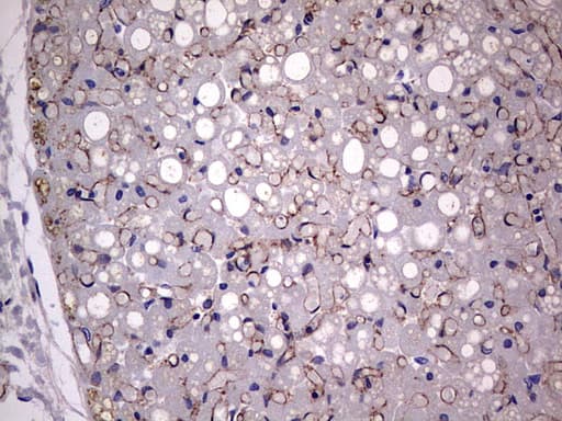 Monoclonal Mouse anti-Human Adiponectin Antibody (clone OTI2E2, aa19-244, IHC, WB)