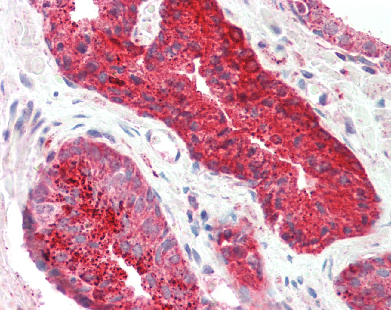 PDEF / SPDEF Antibody (aa182-231, FITC)