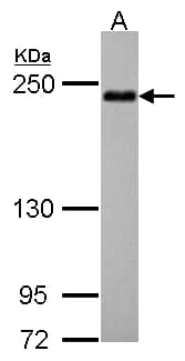 IHC-plus™ Polyclonal Rabbit anti-Human SHROOM2 Antibody (IHC, WB)
