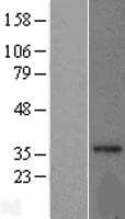 MRPL15 Protein (Over-Expression Lysate Myc-DDK (Flag))