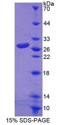 Human RND1 Protein (Recombinant His-T7)