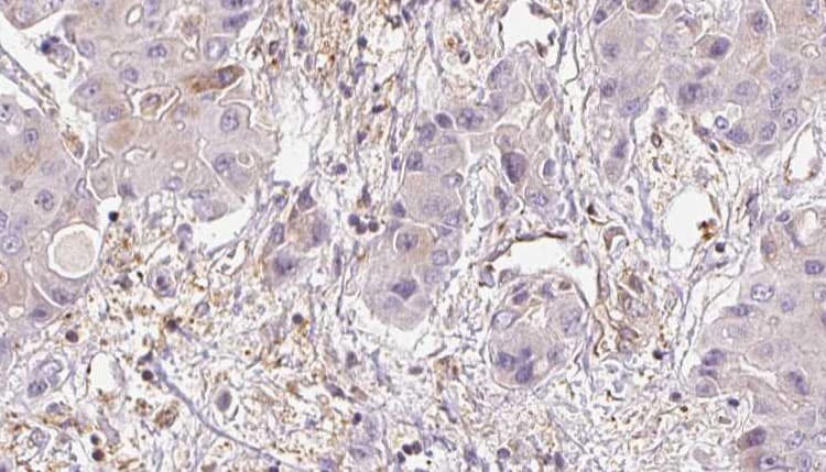 MRGD / MRGPRD Antibody