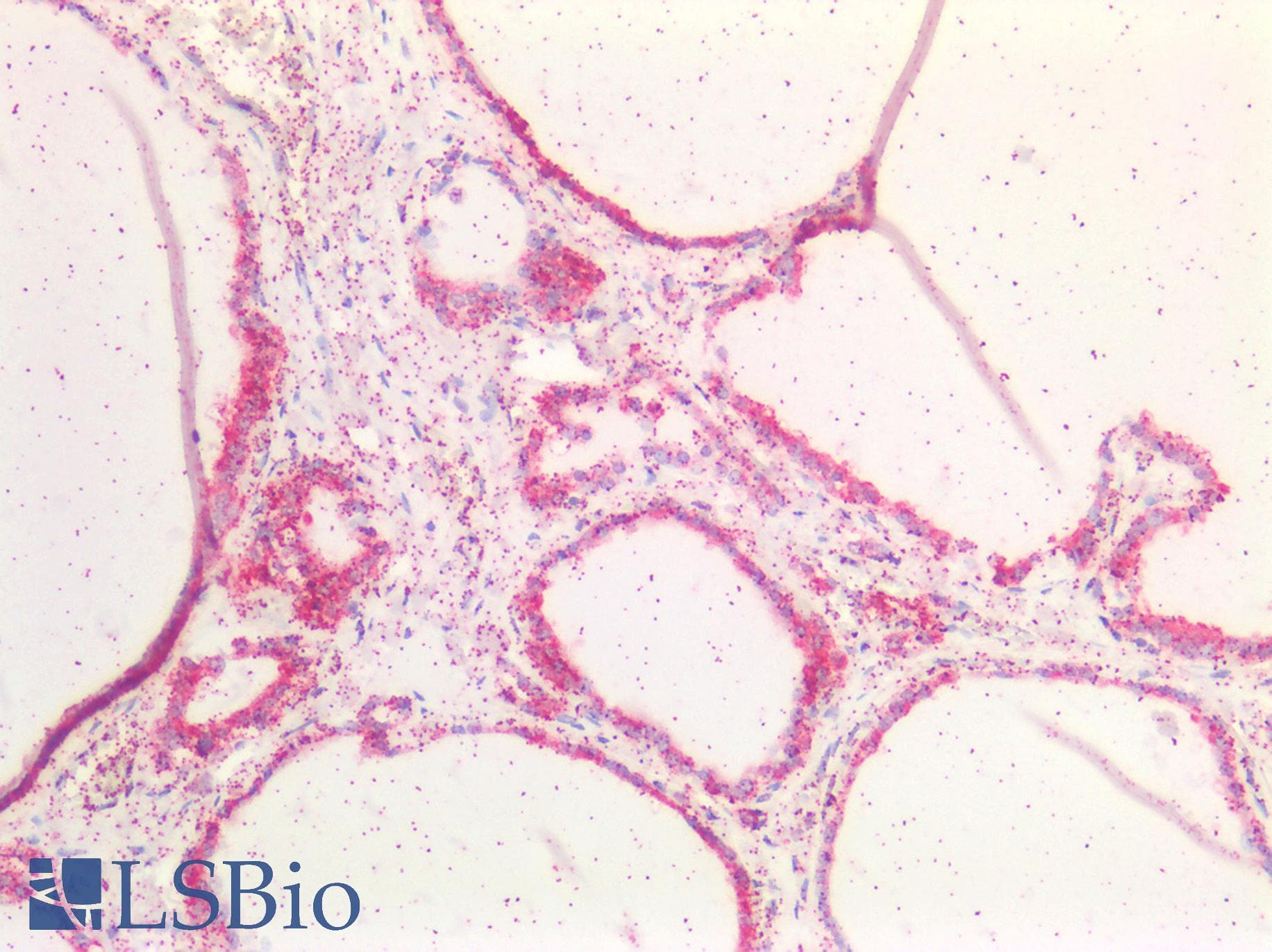 IHC-plus™ 5-Alpha Reductase / SRD5A1 Antibody