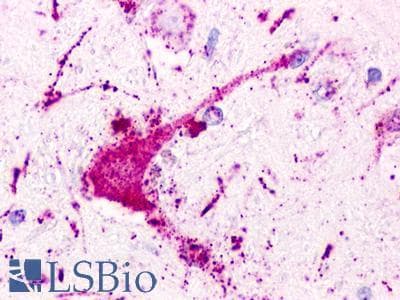 PathPlus™ Polyclonal Rabbit anti-Human P2RY1 / P2Y1 Antibody (Extracellular Domain, IHC)