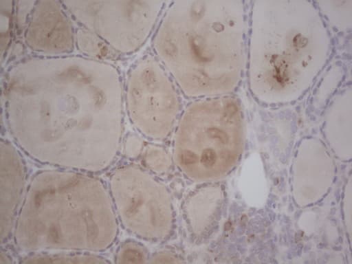GABRA5 Antibody (aa32-259, clone OTI1G9, Carrier-free)