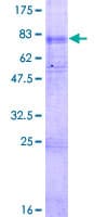 Human SLC22A5 / OCTN2 Protein (Recombinant GST)