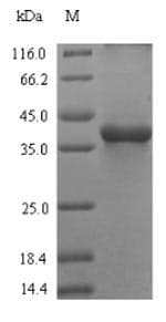 Cow Complement C3 Protein (Recombinant 6His-SUMO, N-terminus)