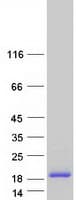 Human SAMD13 Protein (Recombinant Myc-DDK (Flag))