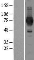 NADSYN1 / NAD Synthetase Protein (Over-Expression Lysate Myc-DDK (Flag))